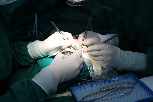 【医疗技术】南方医院泰成逸园分院成功完成高难度拇指断指再植术
