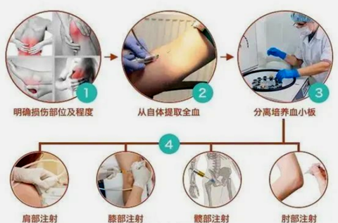 提高疼痛诊疗服务|南方医院泰成逸园分院成立麻醉科疼痛门诊