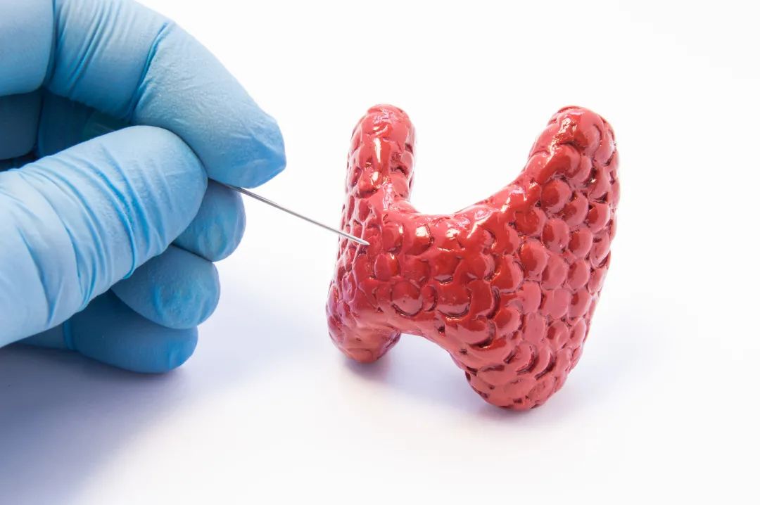 重视甲状腺健康·定期检查甲状腺！