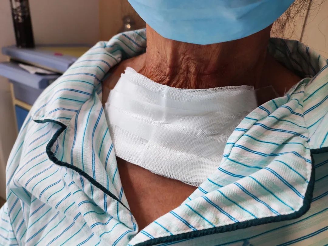 泰成逸园医院外科顺利完成一例甲状腺癌根治手术
