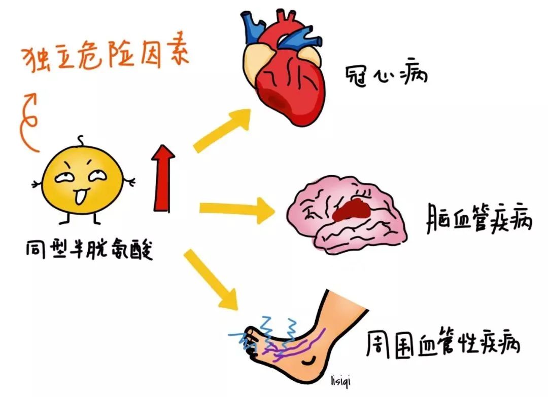 同型半胱氨酸：健康体检时，不容忽视的检查项目